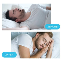 Load image into Gallery viewer, Sleep Essentials™ - Anti-snoring Nose Clip
